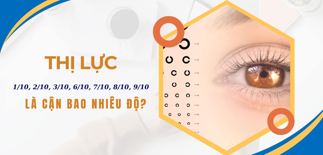 Thị lực 1/10, 2/10, 3/10, 6/10, 7/10, 8/10, 9/10 là cận bao nhiêu độ?