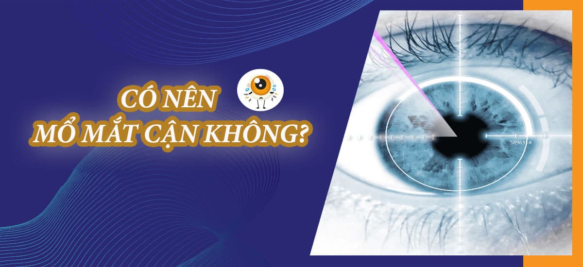 Có nên mổ mắt cận không