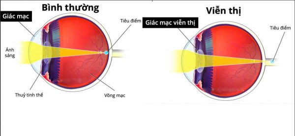 Viễn Thị