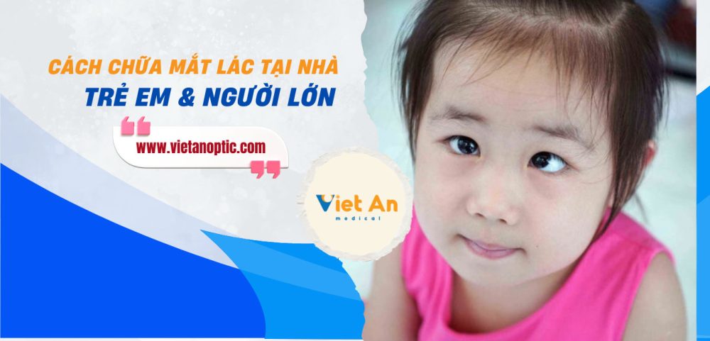 Cách chữa mắt lác tại nhà HIỆU QUẢ cho Trẻ em & Người lớn