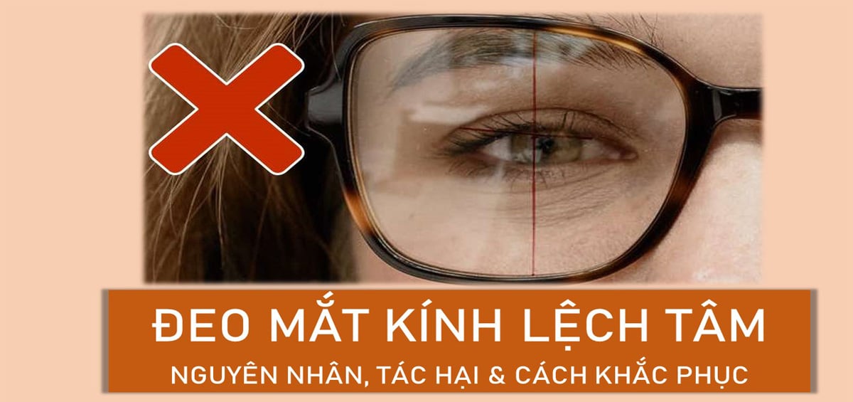 Dấu hiệu, nguyên nhân & cách khắc phục kính lệch tâm