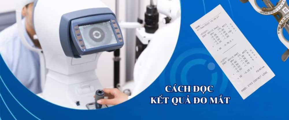 Cách đọc kết quả đo mắt [Ý NGHĨA CÁC CHỈ SỐ]