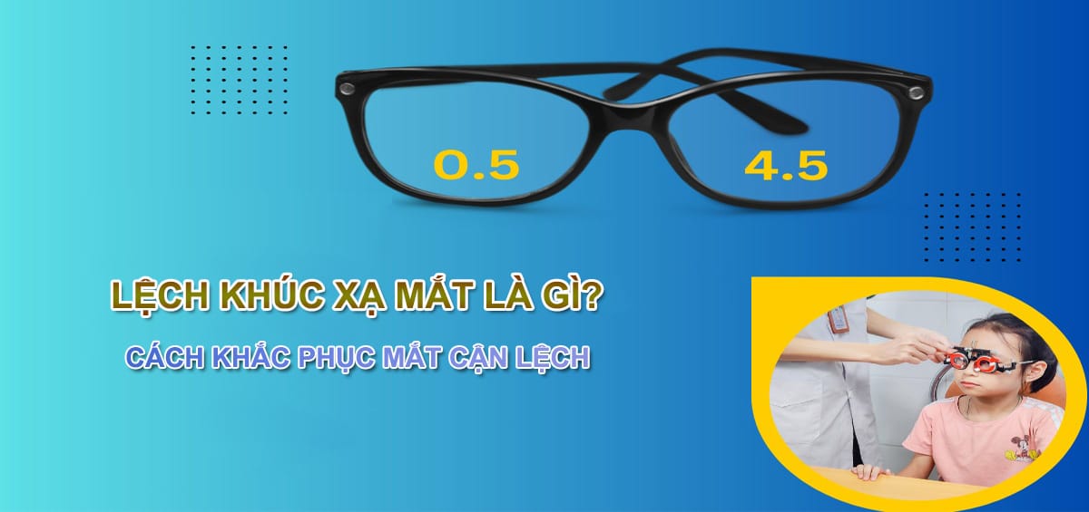 Cách khắc phục mắt cận lệch