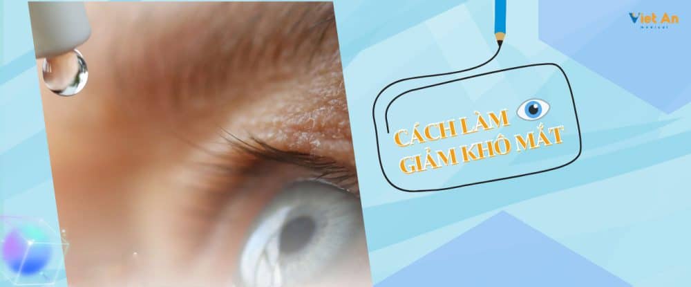 Cách làm giảm khô mắt [GIẢI PHÁP] từ chuyên gia nhãn khoa