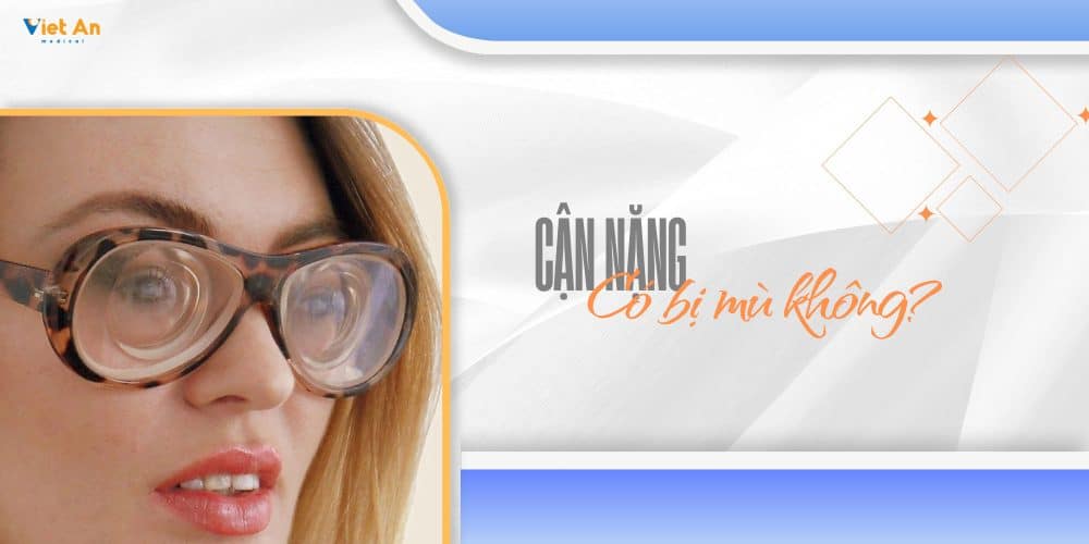 Cận nặng có bị mù không? LƯU Ý CỰC QUAN TRỌNG