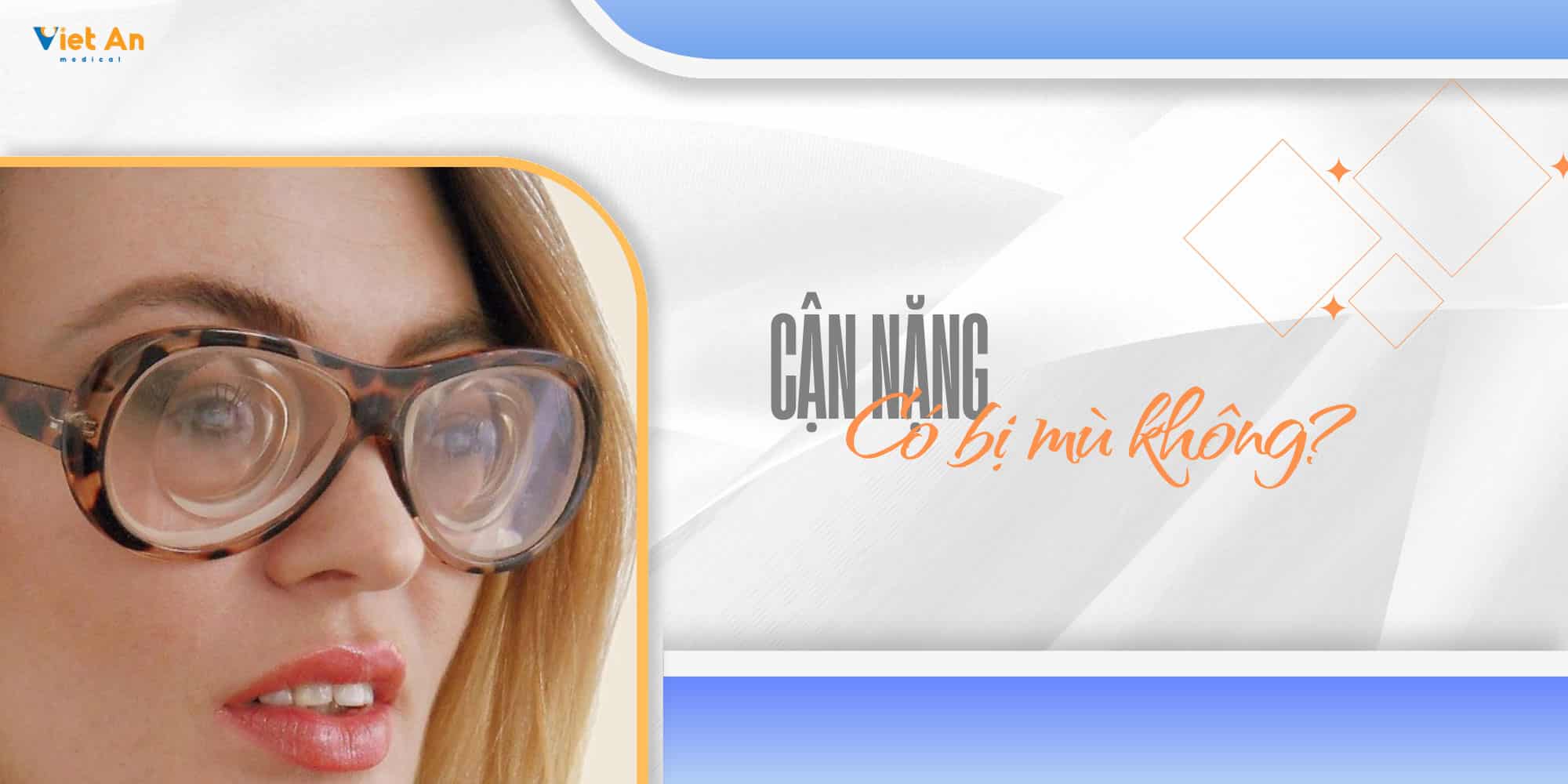 Cận nặng có bị mù không? LƯU Ý CỰC QUAN TRỌNG