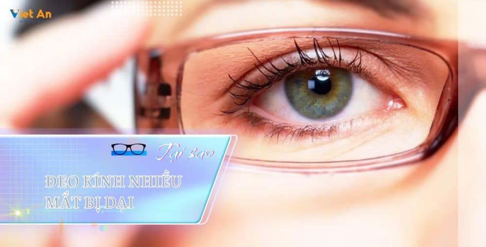 Tại sao đeo kính nhiều mắt bị dại "LỜ ĐỜ"
