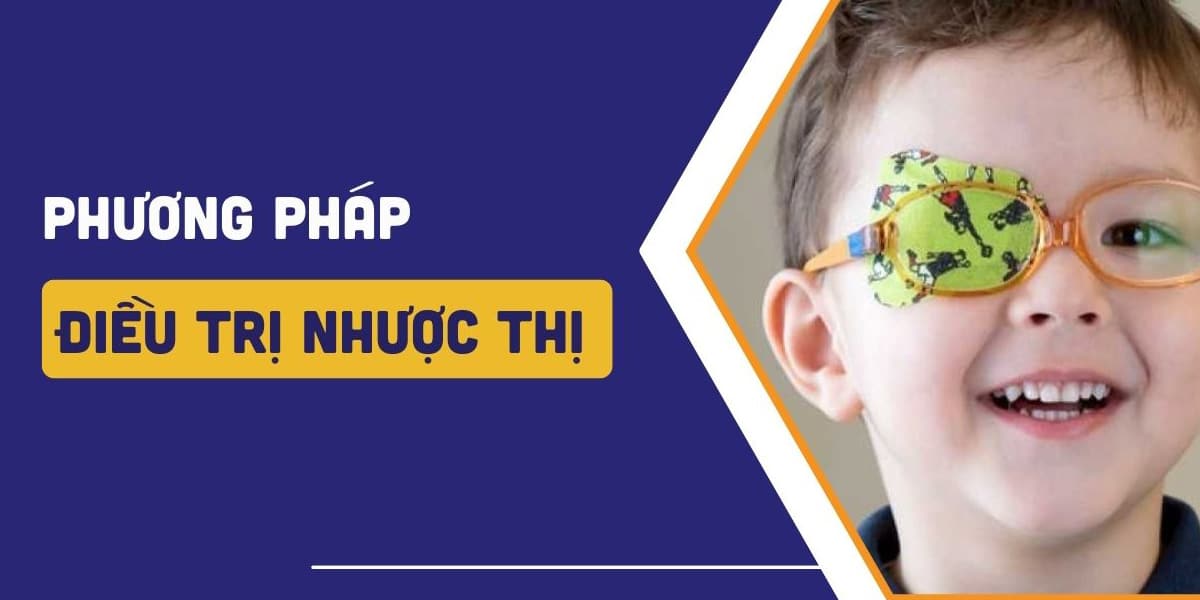 Phương pháp điều trị nhược thị ở trẻ em